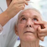 Quais colírios usar no pós-operatório de catarata? 